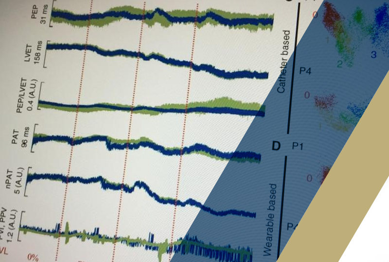 Georgia Tech, Wearable Device Could Help EMTs, Surgeons Assess Hemorrhage Blood Loss